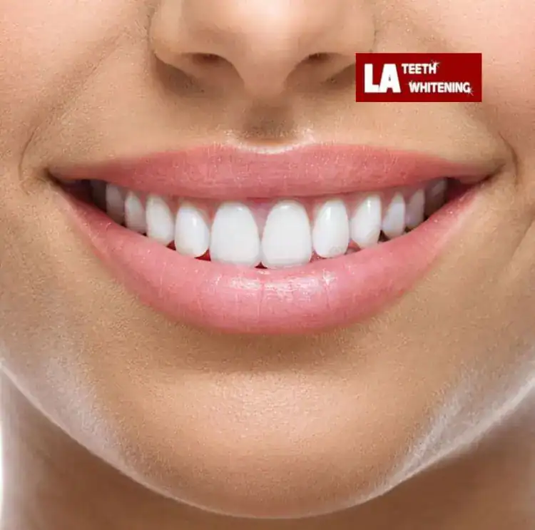 1 Hour Teeth Whitening Coalville Coalville